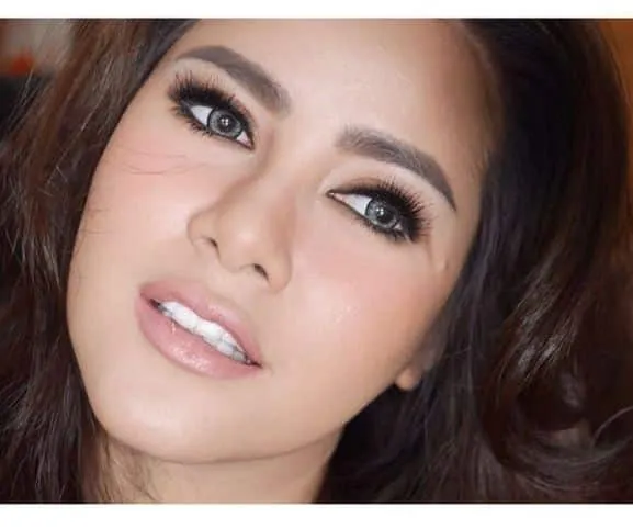 5 Hal Penting Tentang Veneer Gigi yang Kamu Perlu Tau