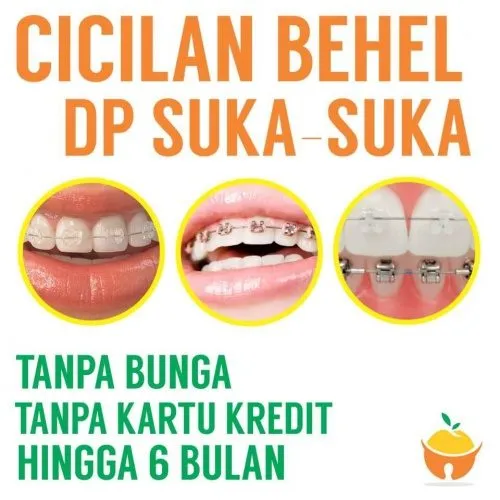 DP Suka-SUka