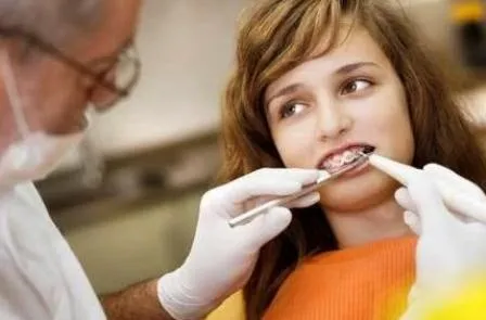 Tempat Pasang Gigi Behel Terjangkau Hanya di Orange Dental