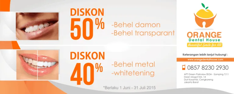 Pasang Behel dan Whitening Diskon Hingga 50%