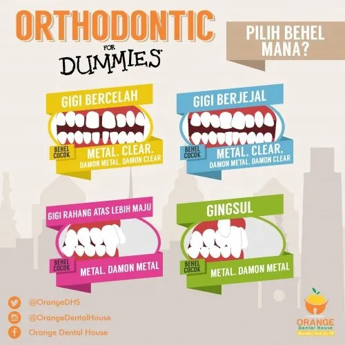 Orthodontic for Dummies – Jenis Behel dan Harga Behel yang Cocok untuk Kamu