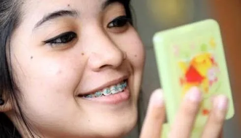 Mengapa Harga Pasang Behel di Dokter Gigi Mahal?