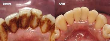 Scaling Stain