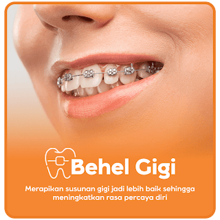 Behel Gigi