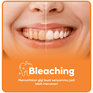 Whitening