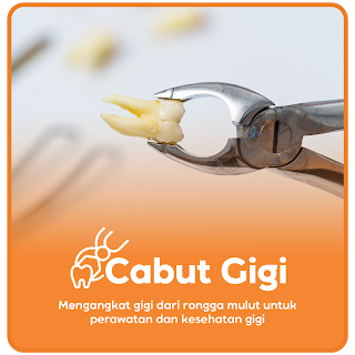 Cabut Gigi