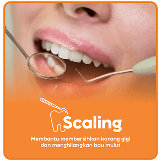 Scaling Gigi