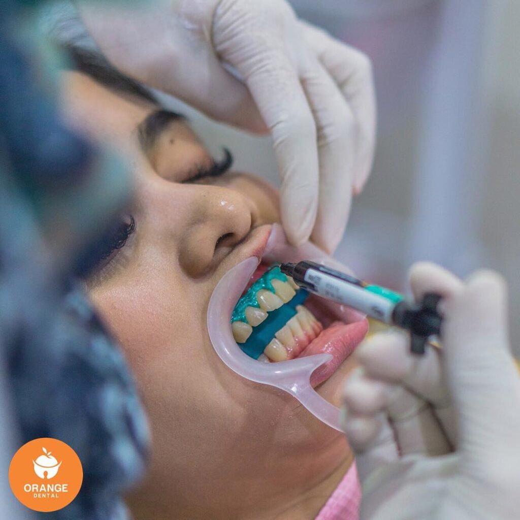 2 Cara Memutihkan Gigi Secara Alami Dan Di Klinik Gigi Pilih Mana