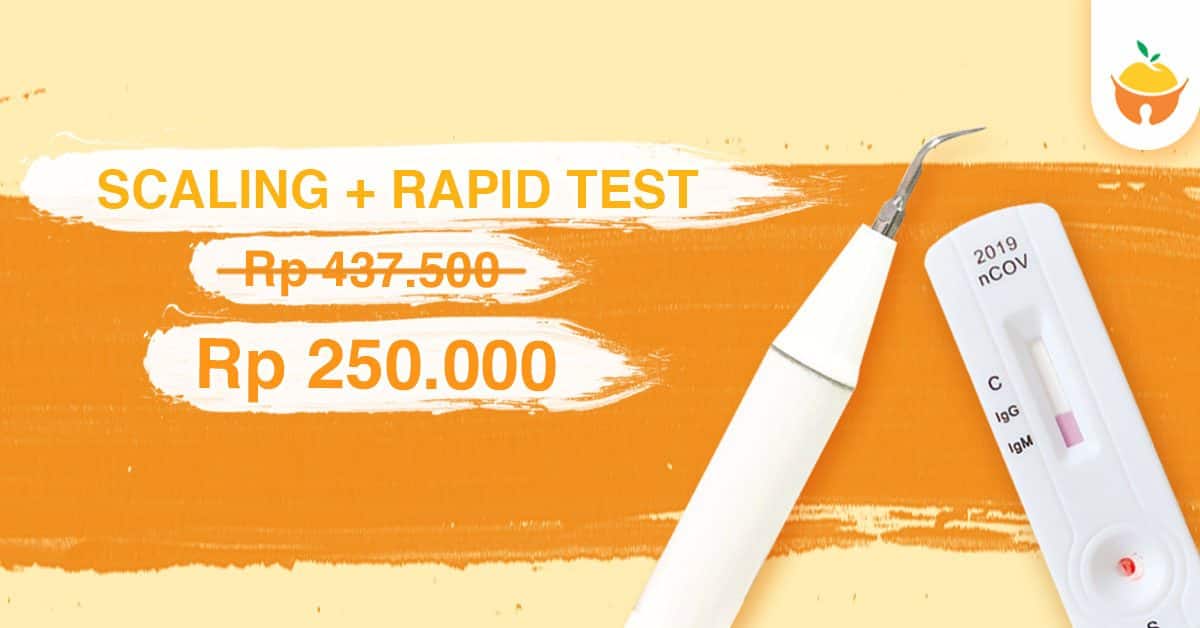 SCALING+RAPID TEST LANDSCAPE Bersihkan Karang Gigi dan Rapid Test Murah